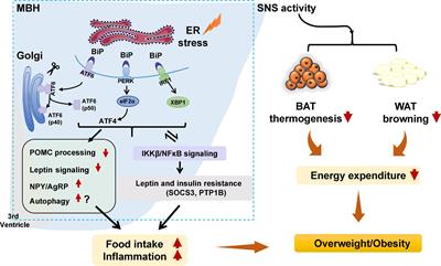 The role of hypothalamic endoplasmic reticulum stress in schizophrenia and antipsychotic-induced weight gain: A narrative review